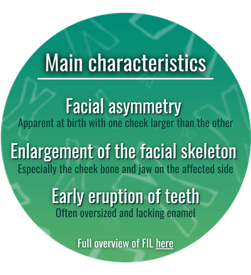 Main features of Facial Infiltrating Lipomatosis